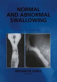 Enlarge image Cover: Normal and Abnormal Swallowing - Springer