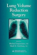 Bild: Lung Volume Reduction Surgery - Springer
