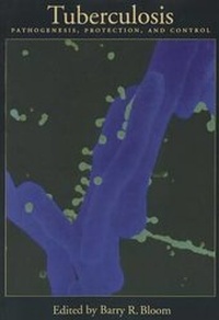 Enlarge image Cover: Tuberculosis - American Society for Microbiology