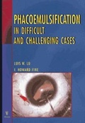 Cover: Phacoemulsification in Difficult and Challenging Cases - Thieme