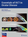 Cover: Essentials of OCT in Ocular Disease - Thieme Publishers