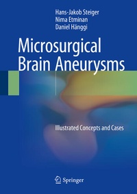 Bild: Microsurgical Brain Aneurysms - Springer