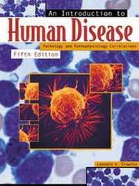 Abbildung von: An Introduction to Human Disease: Pathology and Pathophysiology Correlations - Jones and Bartlett Publishers, Inc
