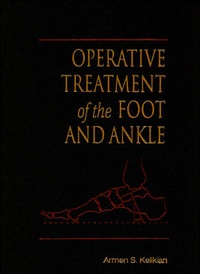 Abbildung von: Operative Treatment of the Foot and Ankle - Appleton & Lange