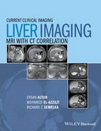 Abbildung von: Liver Imaging - Wiley-Blackwell
