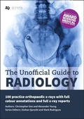 Cover: The Unofficial Guide to Radiology: 100 Practice Orthopaedic X Rays with Full Colour Annotations and Full X Ray Reports - Zeshan Qureshi