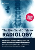 Cover: Unofficial Guide to Radiology: 100 Practice Abdominal X Rays with Full Colour Annotations and Full X Ray Reports - Zeshan Qureshi