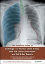 Cover: The Unofficial Guide to Radiology: 100 Practice Chest X Rays with Full Colour Annotations and Full X Ray Reports - Zeshan Qureshi