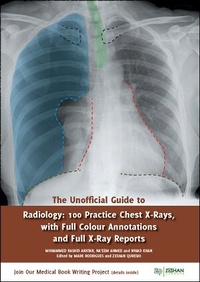 Enlarge image Cover: The Unofficial Guide to Radiology: 100 Practice Chest X Rays with Full Colour Annotations and Full X Ray Reports - Zeshan Qureshi