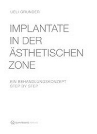 Abbildung von: Implantate in der ästhetischen Zone - Quintessenz Verlag