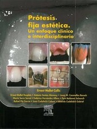 Abbildung von: Protesis Fija Estetica - Elsevier