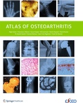 Cover: Atlas of Osteoarthritis - Springer Healthcare