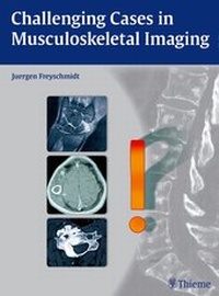 Enlarge image Cover: Challenging Cases in Musculoskeletal Imaging - Thieme