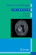 Cover: Neuro-oncologie in beeld - Bohn Stafleu Van Loghum