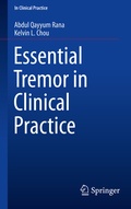 Bild: Essential Tremor in Clinical Practice - Springer