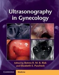 Cover: Ultrasonography in Gynecology - Cambridge University Press