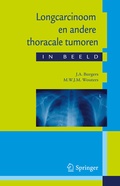 Cover: Longcarcinoom en andere thoracale tumoren in beeld - Bohn Stafleu Van Loghum