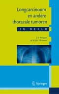 Cover: Longcarcinoom en andere thoracale tumoren in beeld - Bohn Stafleu Van Loghum