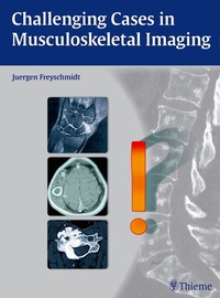 Enlarge image Cover: Challenging Cases in Musculoskeletal Imaging - Thieme