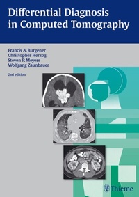Abbildung von: Differential Diagnosis in Computed Tomography - Thieme