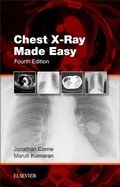 Cover: Chest X-Ray Made Easy E-Book - Elsevier