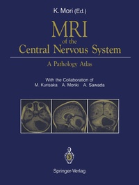 Abbildung von: MRI of the Central Nervous System - Springer