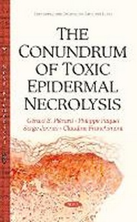 Abbildung von: Conundrum of Toxic Epidermal Necrolysis - Nova Science Publishers Inc