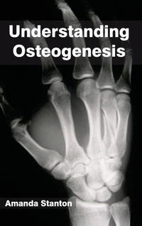 Abbildung von: Understanding Osteogenesis - Callisto Reference