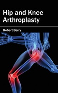 Cover: Hip and Knee Arthroplasty - Hayle Medical