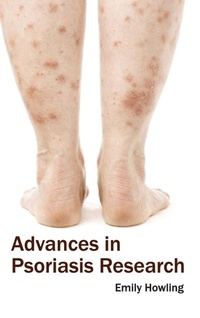 Enlarge image Cover: Advances in Psoriasis Research - Foster Academics