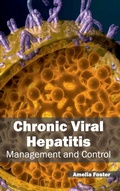 Cover: Chronic Viral Hepatitis: Management and Control - Foster Academics
