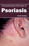 Cover: Comprehensive Overview of Psoriasis - Foster Academics