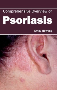 Enlarge image Cover: Comprehensive Overview of Psoriasis - Foster Academics