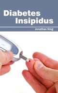 Cover: Diabetes Insipidus - Foster Academics