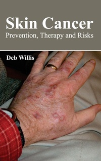 Enlarge image Cover: Skin Cancer: Prevention, Therapy and Risks - Foster Academics