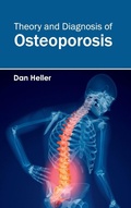 Cover: Theory and Diagnosis of Osteoporosis - Foster Academics