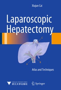 Abbildung von: Laparoscopic Hepatectomy - Springer