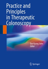 Abbildung von: Practice and Principles in Therapeutic Colonoscopy - Springer
