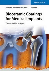 Abbildung von: Bioceramic Coatings for Medical Implants - Wiley-VCH