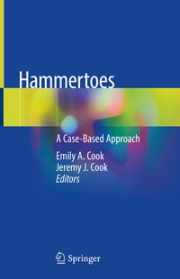 Abbildung von: Hammertoes - Springer