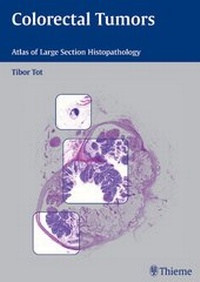 Abbildung von: Colorectal Tumors - Thieme
