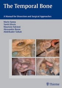 Abbildung von: The Temporal Bone - Thieme