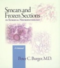 Cover: Smears and Frozen Sections in Surgical Neuropathology - PB Medical Publishing, LLC