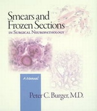 Abbildung von: Smears and Frozen Sections in Surgical Neuropathology - PB Medical Publishing, LLC