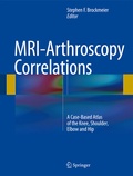 Cover: MRI-Arthroscopy Correlations - Springer