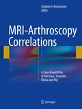 Cover: MRI-Arthroscopy Correlations - Springer