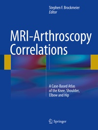 Abbildung von: MRI-Arthroscopy Correlations - Springer