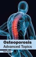 Cover: Osteoporosis: Advanced Topics - Foster Academics