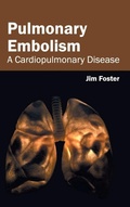 Cover: Pulmonary Embolism: A Cardiopulmonary Disease - Foster Academics