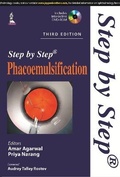 Cover: Step by Step Phacoemulsification - Jaypee Brothers Medical Publishers